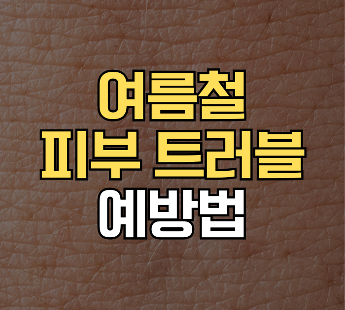 여름철 피부 트러블 예방법